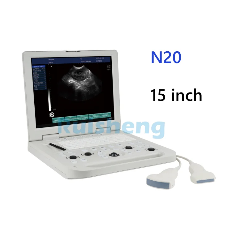 Ruisheng N20 Ultrasound Machine Laptop Mindray Ultrasound Portable Ultrasound Machine