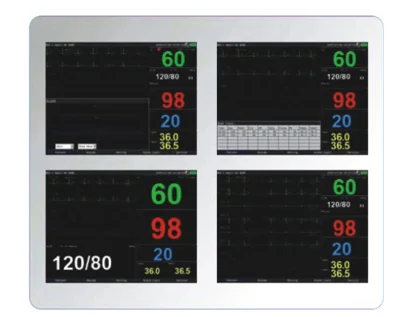 MT MEDICAL Veterinary Equipment 8inch Patient Monitor Multi-Parameter Patient Monitor for Animals