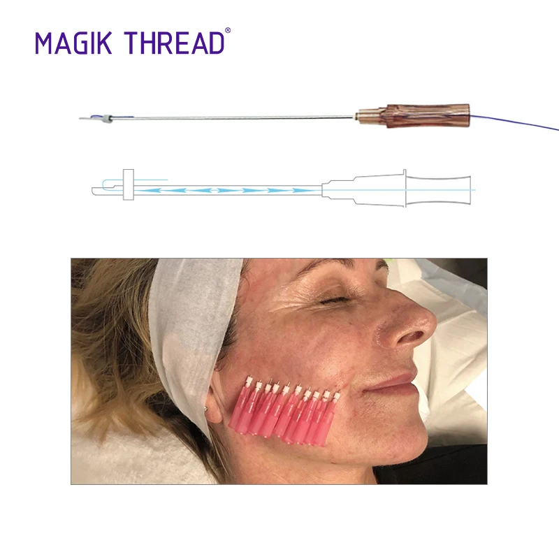 Magik Thread 100mm molding hilos tensores secret line buy best price pdo molding cog thread