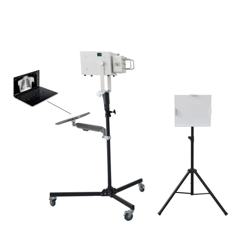 Portable x ray machine high frequency 100mA medical x ray machine foldable out door physical examination