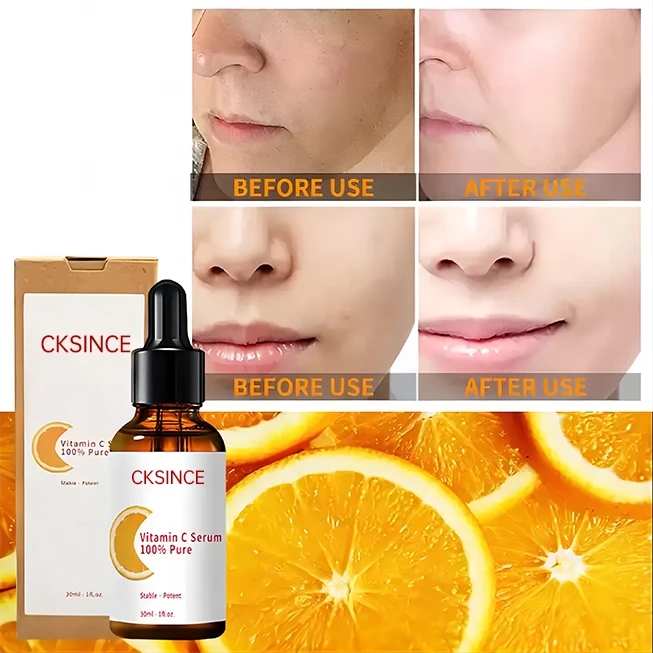 Wholesale Serum Facial Removes Dark Spot Natural Paraben-Free Lightening Skin Tone Vegan Organic Vitamin C Serum Anti Aging