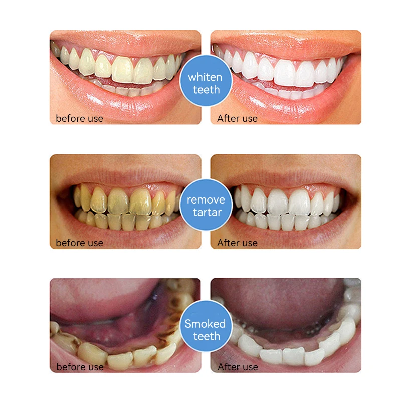 Wholesale Toothpaste Hot Sale 100g Hydroxyapatite Whitening Toothpaste