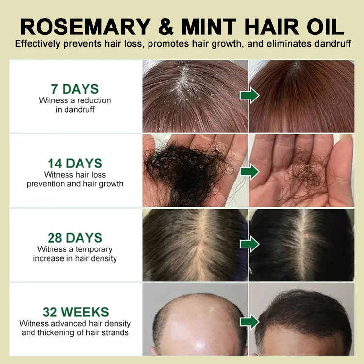 Private Label 80Ml Rosemary Hair Essential Oils For Natural Hair Growth