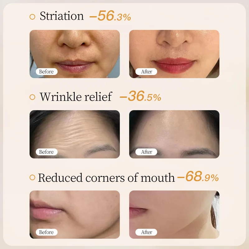 Wholesale Astragalus 8 Pcs Set Brightening Best Products Moisture Anti Aging Whitening Skin Care Set