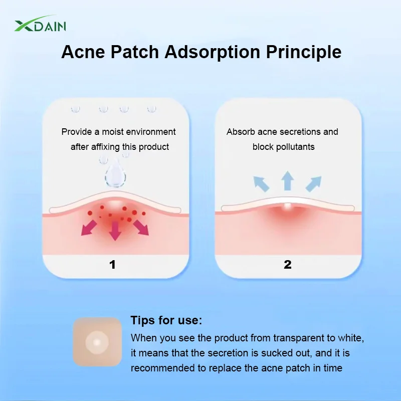New Skin Care Customized star Invisible Waterproof Hydrocolloid Spot Acne Pimples Healing Pimple Patches