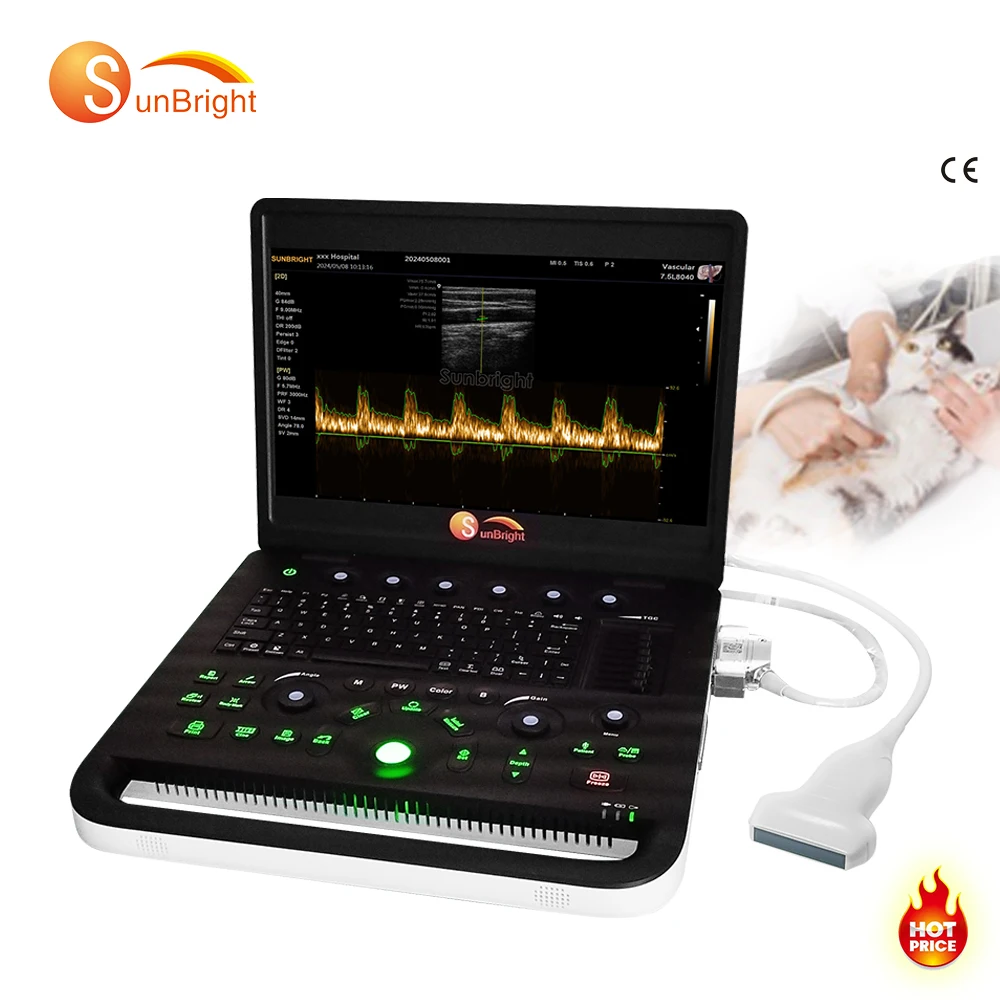 Factory Price Best Sale Notebook Ultrasound Machine Full Digital Laptop human veterinary Ultrasound Ultrasonido