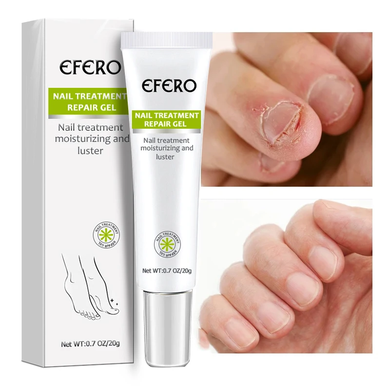 EFERO Herbal Nail Repair Cream Gel Feet Care Anti Infection Onychomycosis Fungal Nail Treatment Cream