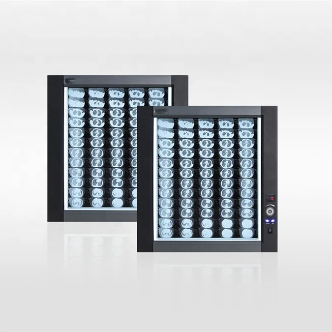 CE X-ray Film Viewer