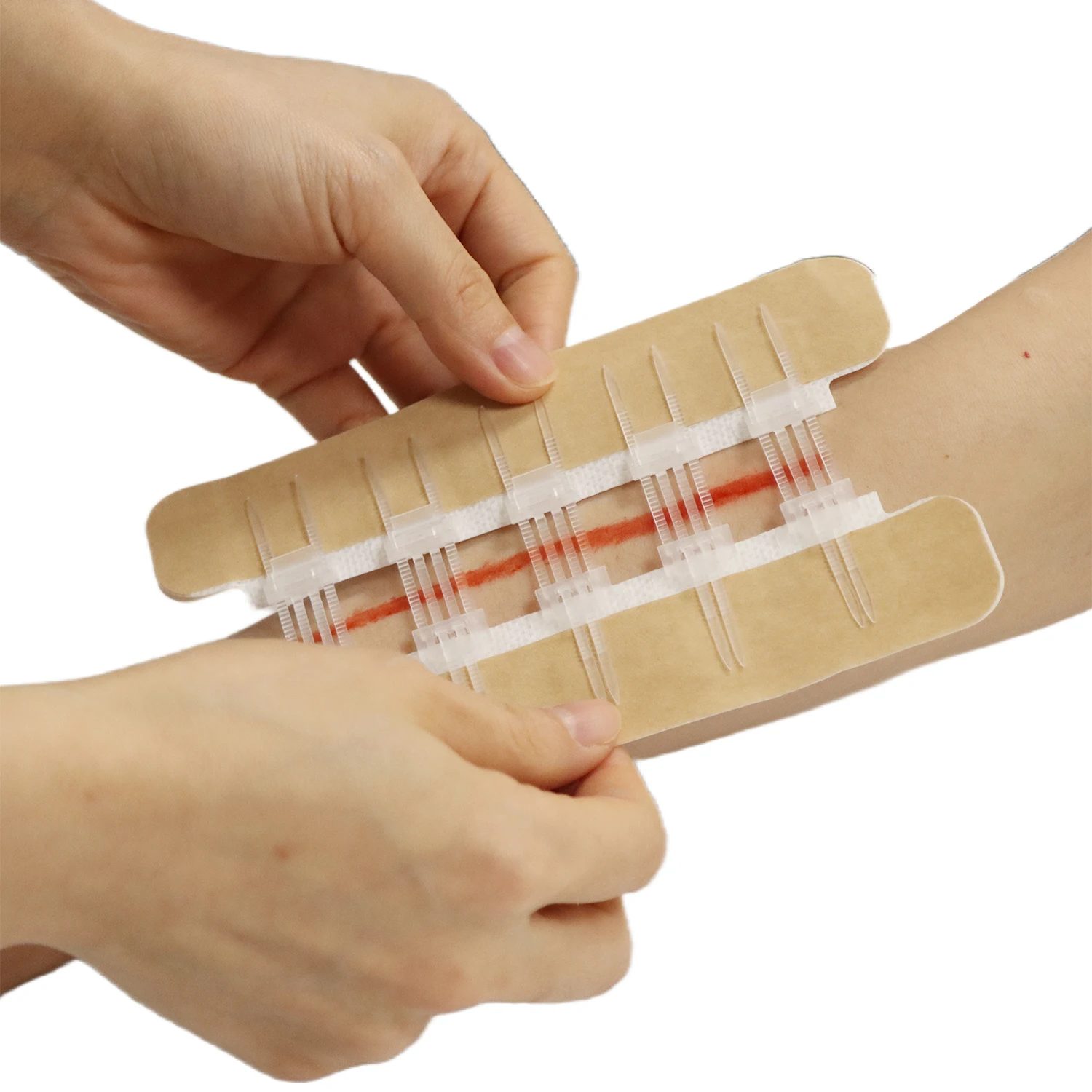 BLUENJOY Sterile Skin Color Wound Closure Device First Aid Wound Care Zip Stitch Wound Device