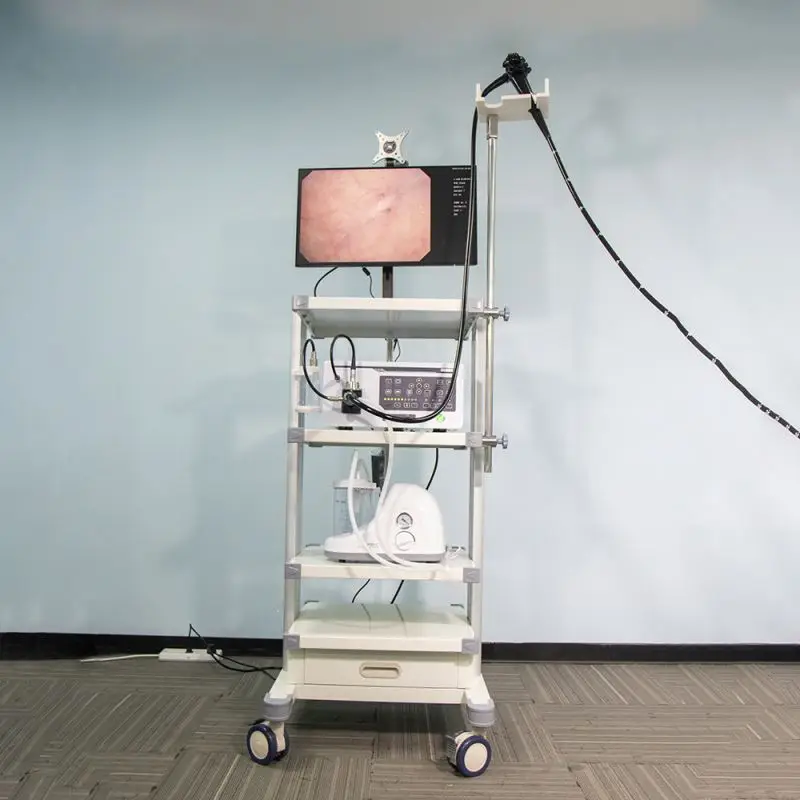 Veterinary Endoscope Video Gastroscope Bronchoscope Endoscopy Machine Price For Equine Or Horse