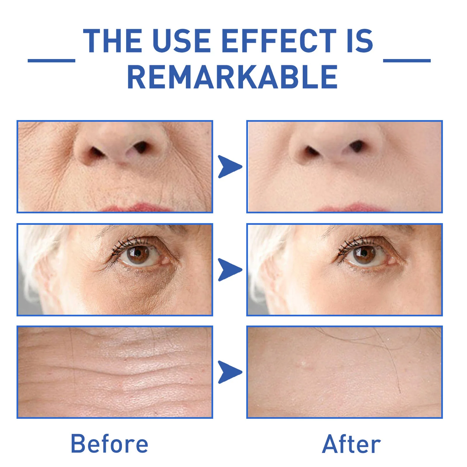 Eelhoe Water Light Cone Shell Peptide Anti-Wrinkle Essence Firming Wrinkles Fishtail Pattern French Lines Skin Care Skin Repair