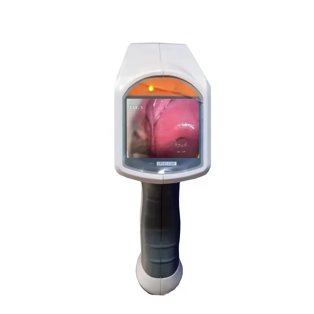 Kernel KN-2200 HD Video Colposcope digital colposcope for gynecology endoscope for cervical cancer and cervical screening