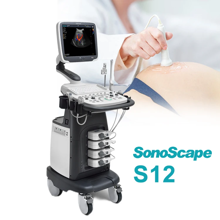Sonoscape S12 Trolley Color Doppler Cardiac ultrasound machine China price
