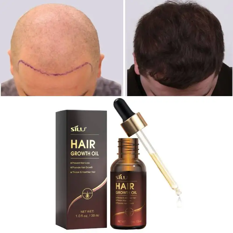 Tahiland hair creams and oil vendors fast hair growth oil black hair for men