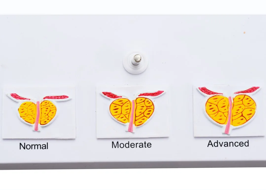 Medical model human urinary reproductive system of males anatomie pelvis with genital model