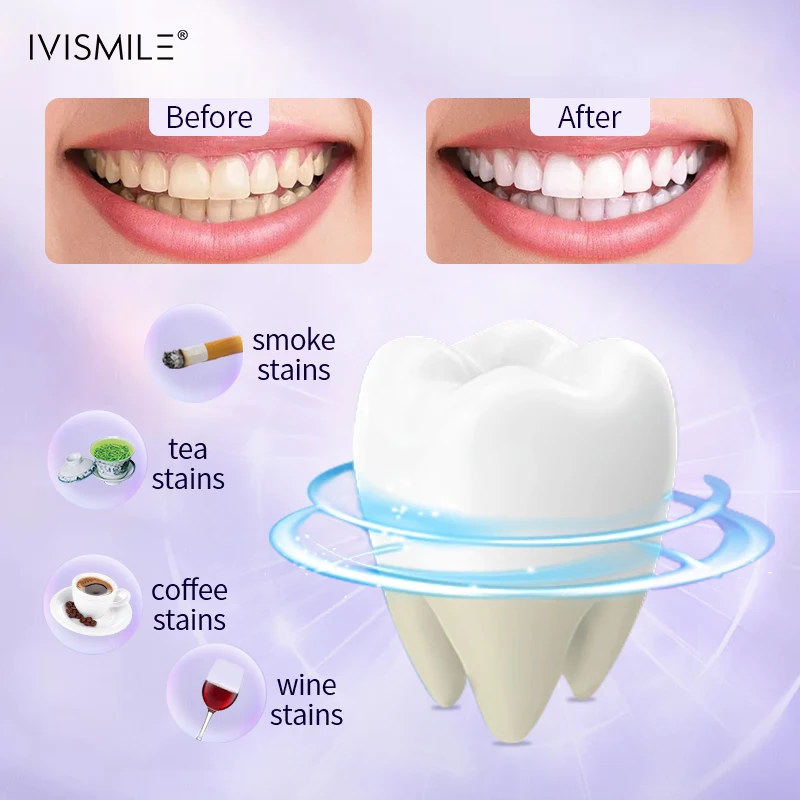 2024 IVISMILE Oral Fresh Mint Sensitivity Free CP HP Teeth Whitening Kit With 32 LED Whitening Blue Light OEM ODM