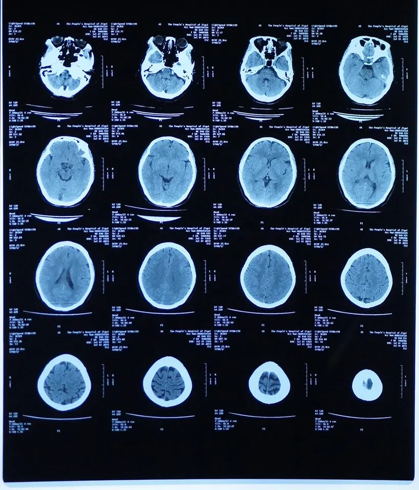Medical X-ray film replace AGFA DT 2B to use on AGFA Drystar 5300 5302 printers