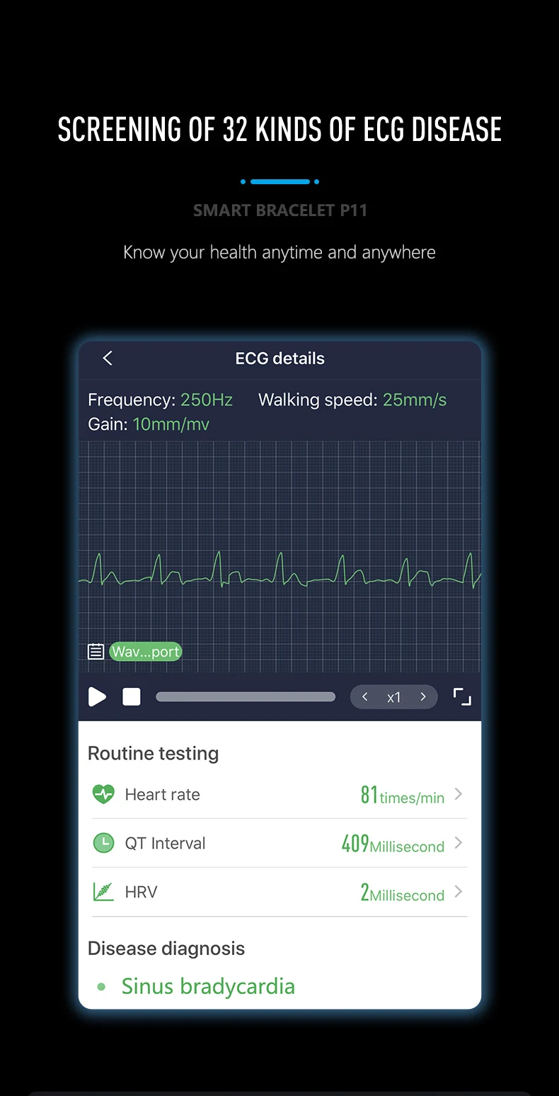 P11 ECG smartwatch (5).jpg