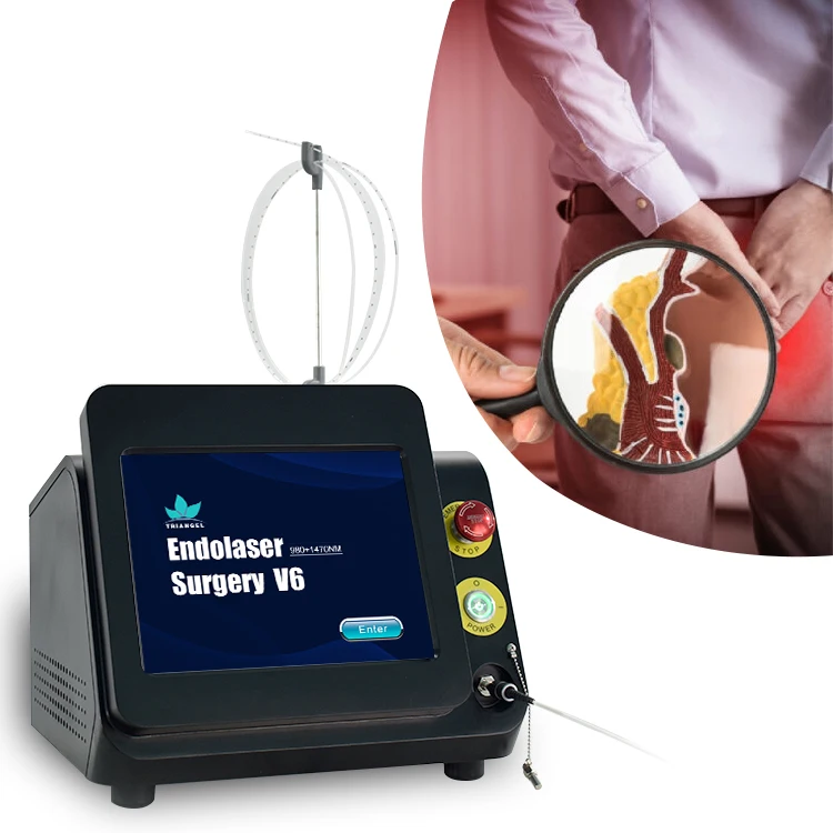 2025 new hemorrhoid surgery  laser  980nm 1470nm diode laser proctology hemorrhoids painless