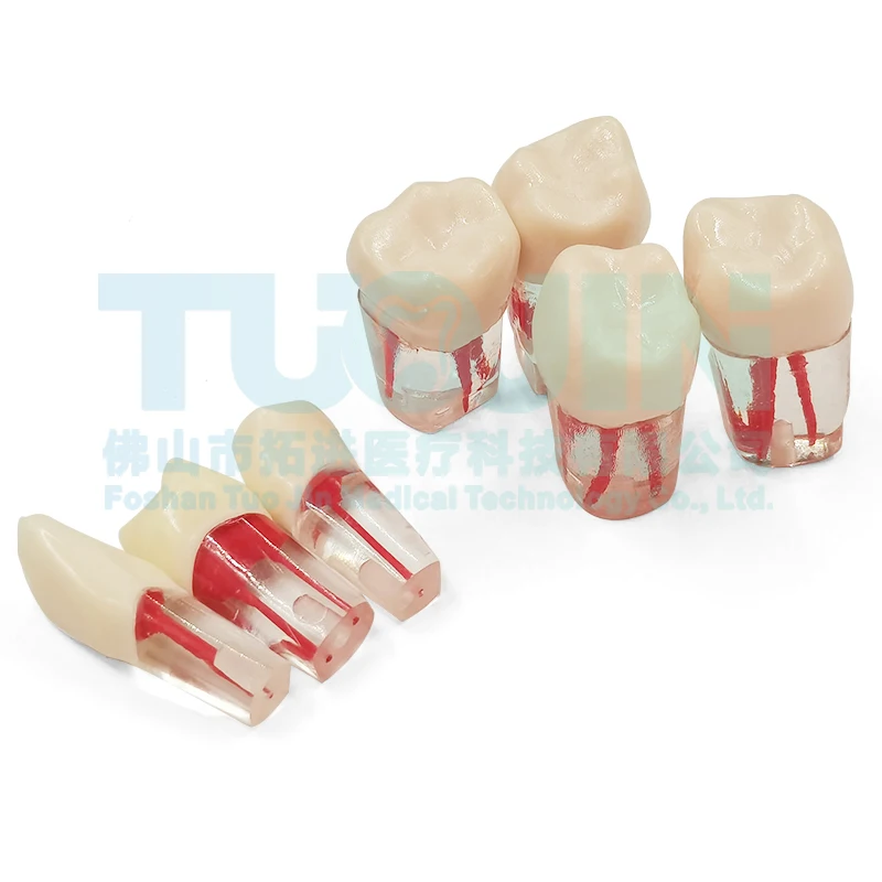  Dental Root Canal Tooth Model/Dental Study Model Laboratory