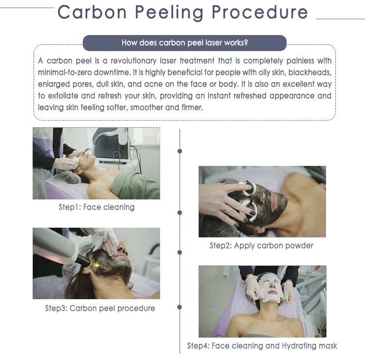AL1 Laser Carbon Peeling.jpg