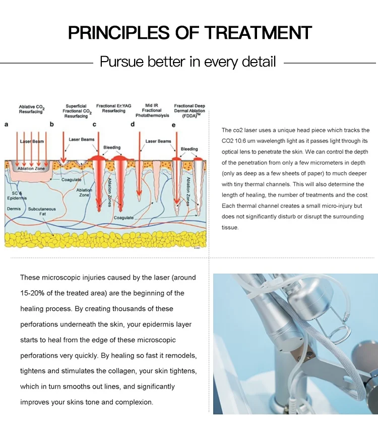 2023 new design laser co2 fractional machine for Vaginal tightening probes