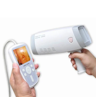 Handheld Video Colposcope