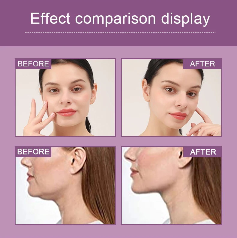 Private Label V Line Shape Face Lifting Mask Tightening Firming Repair Double Chin Reducer Chin Up Patch Lifting Mask