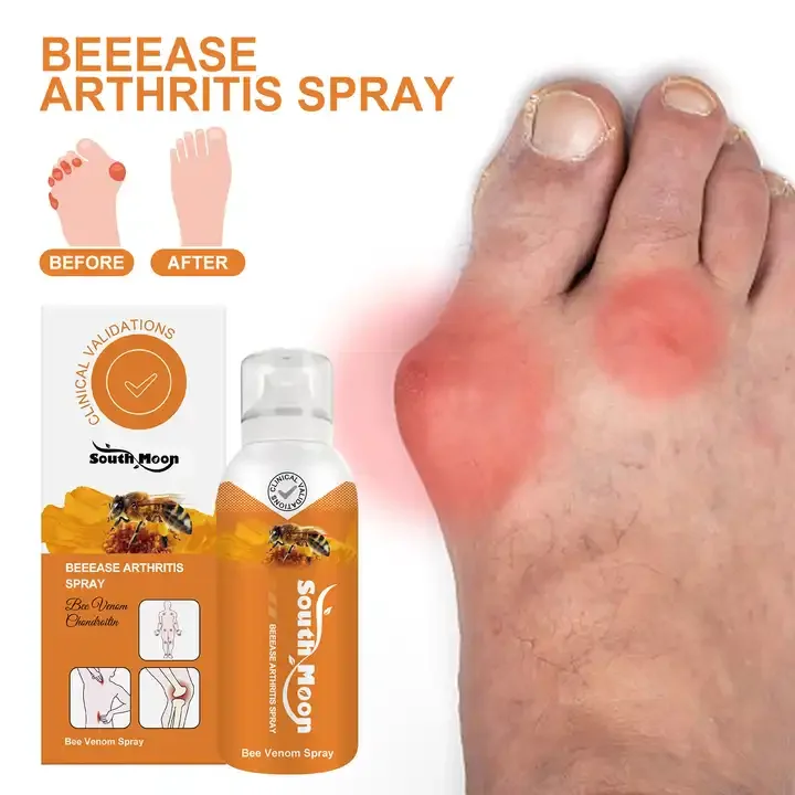 Arthritis Pain Relief Spray Arthritis Pain Relief 100ML Bee Venom Cream Arthritis Treatment