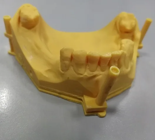dental 3d model
