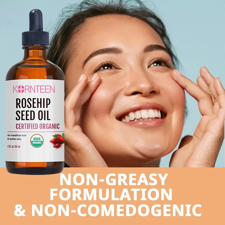 Yanmei Factory Custom Organic Rosehip Seed Oil For Face Skin Glow Cold Pressed Anti aging Rosehip Seed Oil Rosehip Oil
