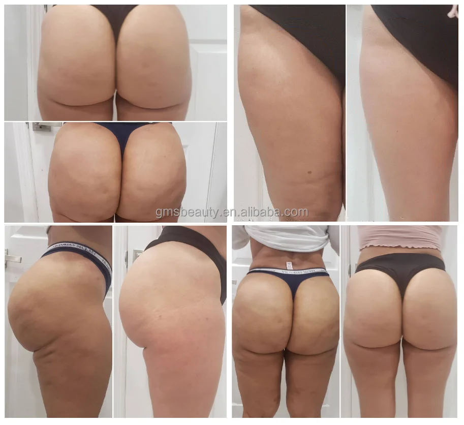 portable-v9-slimming-machine-cavitation-rf-vacuum-roller-bio-laser-slimming-cellulite-reduction-face-shaping-machine