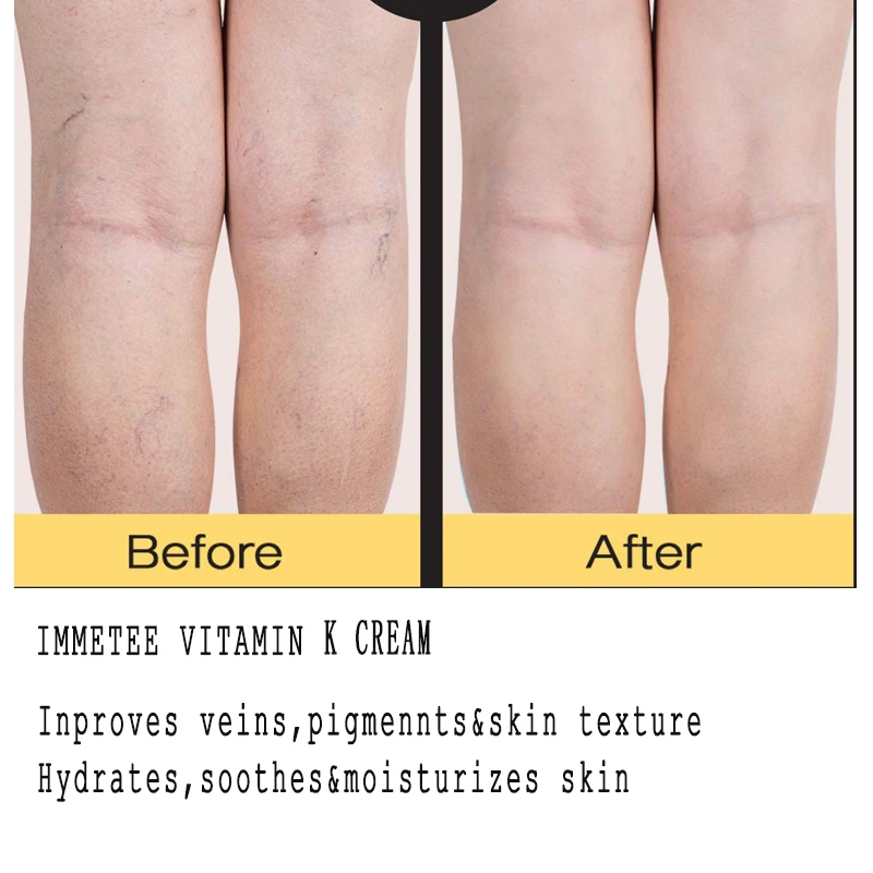 OEM/ODM Moisturizer Face Cream Organic Vitamin Anti Wrickle Nourishing Skin Care Vitamin K Cream