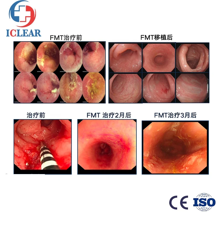 Dual Air Pump Propulsion Portable Colon Hydrotherapy Device for Fmt & Pet Clinics
