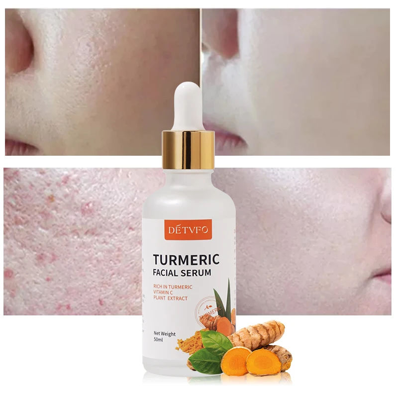 Hydrating vitamin e turmeric dark spot remover whitening facial serum anti aging serum acid anti acne treatment skin care serum
