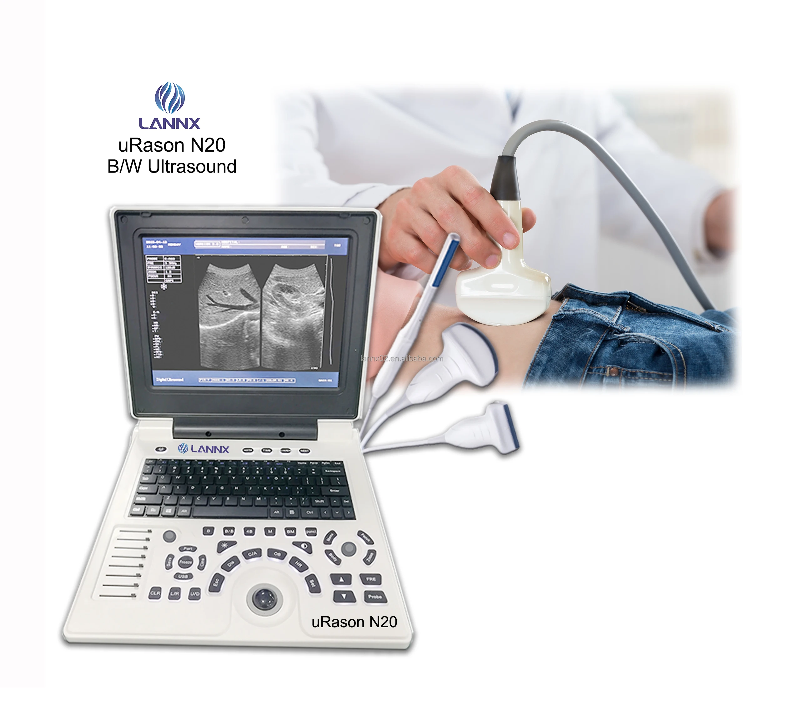 LANNX uRason N20 New Medical digital echocardiography machine For Obstetrics Ultrasonido Portatil Hospital Ultrasound Machine