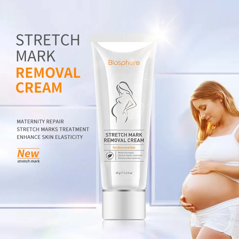 Halal anti stretch marks cream removing stretch marks treatment cream