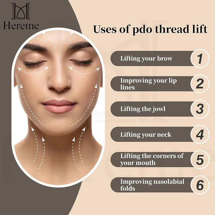 Double Needle Pdo Pcl Plla Thread Nose L Blunt Multi L Fish Bone L/W Blunt Molding Cog Pcl Mesh Thread for Facial Body Lifting