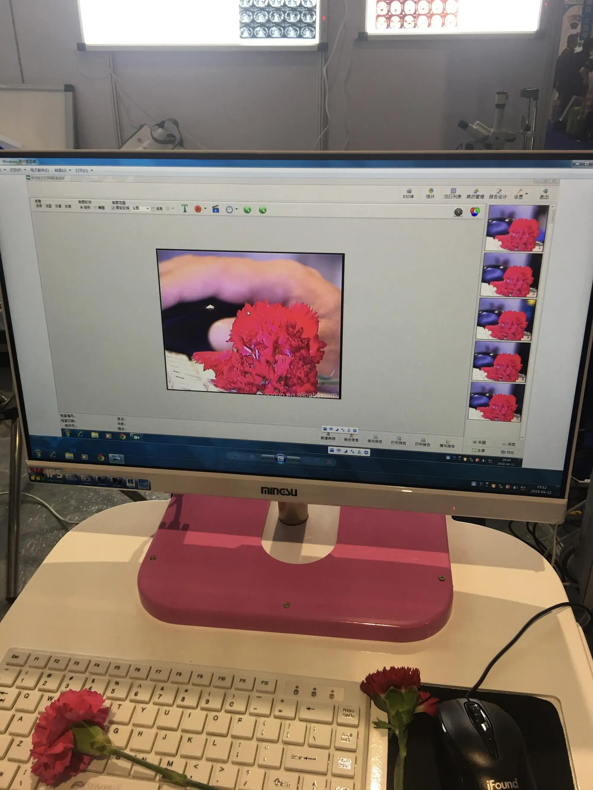 Selling low price HD colposcope for gynecological examination