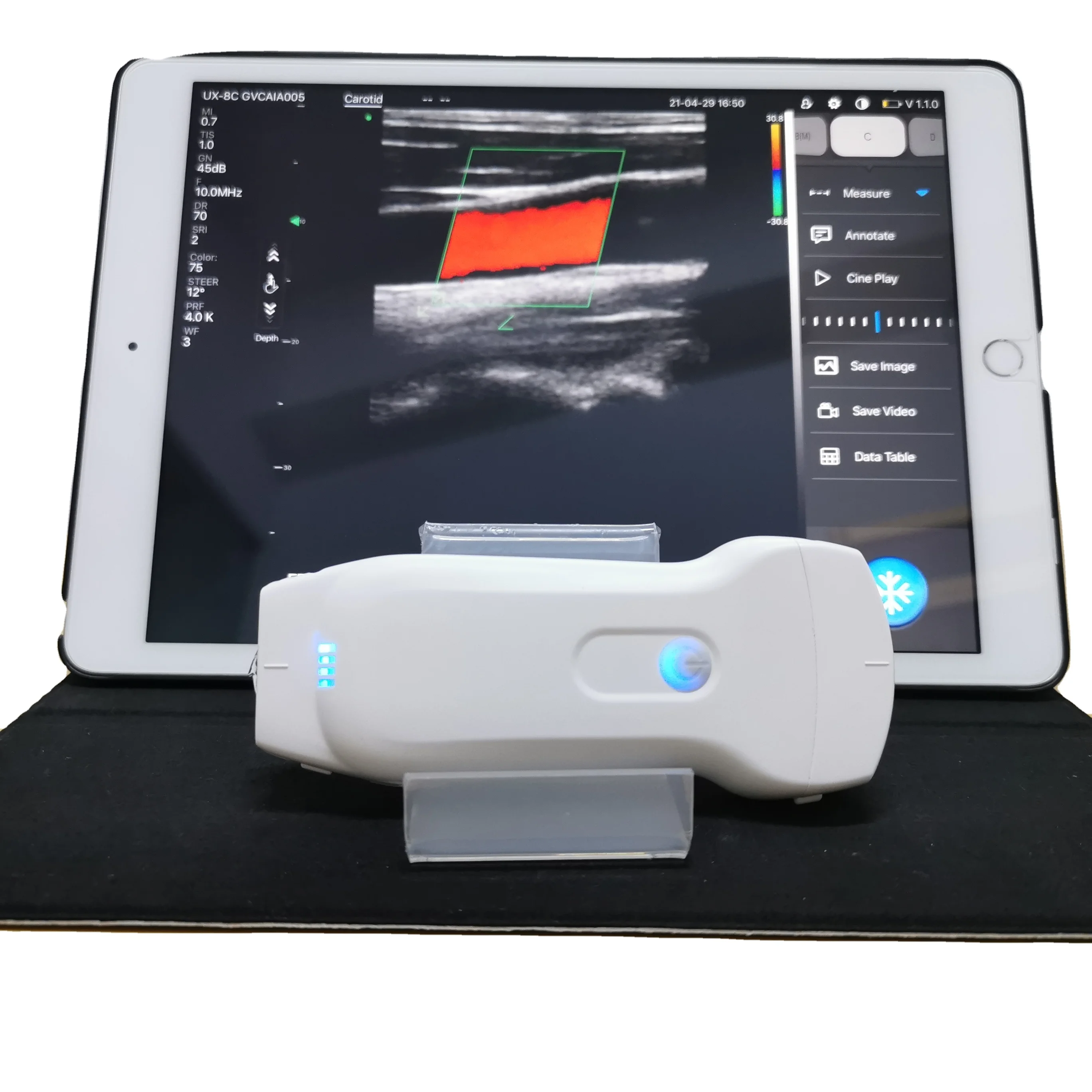 Double Probes Wireless Color Doppler Ultrasound Scanner Wifi Ultrasound MSLPU80
