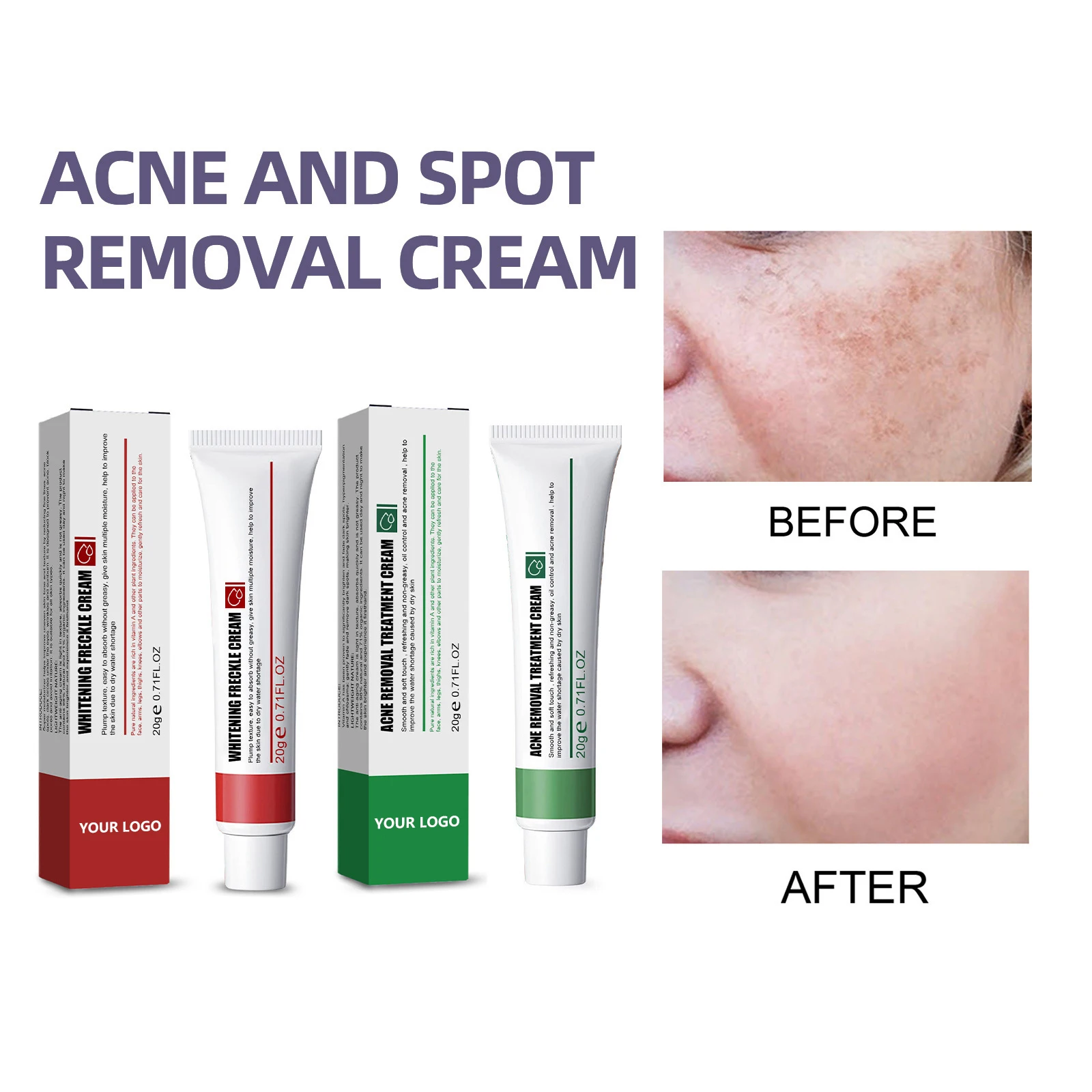 20g Effective Whitening Freckle Cream Remove Acne Dark Spot Fade Pigmentation Melasma Brighten Anti Freckle Cream