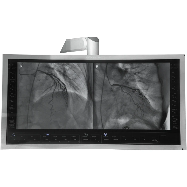 WeMed медицинская флюороскопическая машина Cathlab C arm