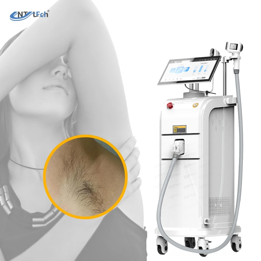UNT hot sale 808 diode laser high power hair removal machine all skin type hair removal professional