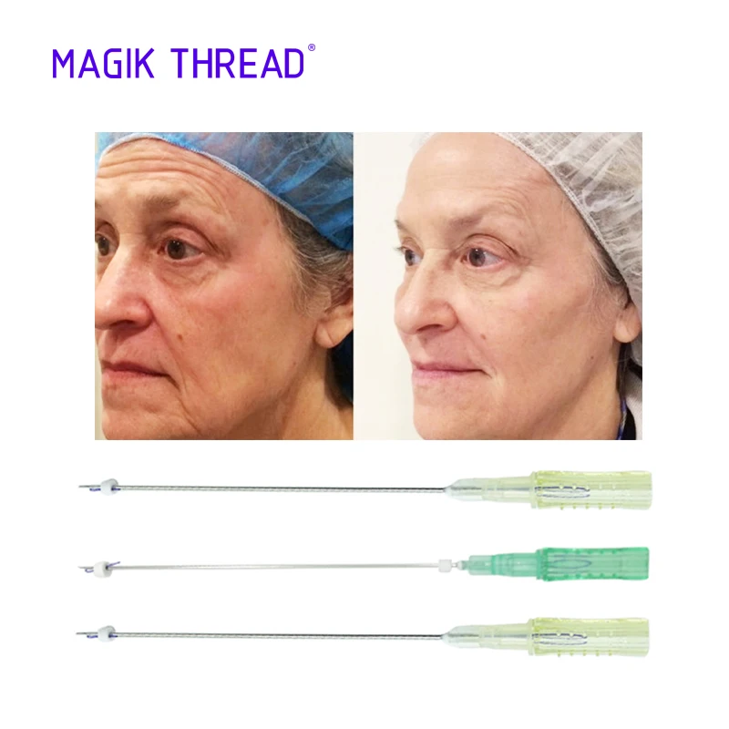  Magik Thread cog 3d 4d 19g 100 мм зазубрина fio nose pdo i силуэт нить лифтинг лица