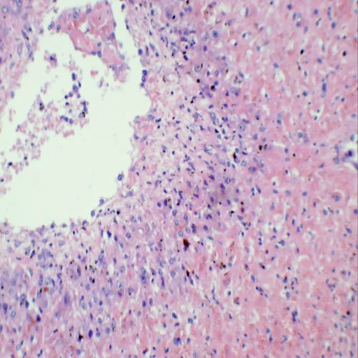 Teaching Microscope Human Pathology Slides (100pcs)