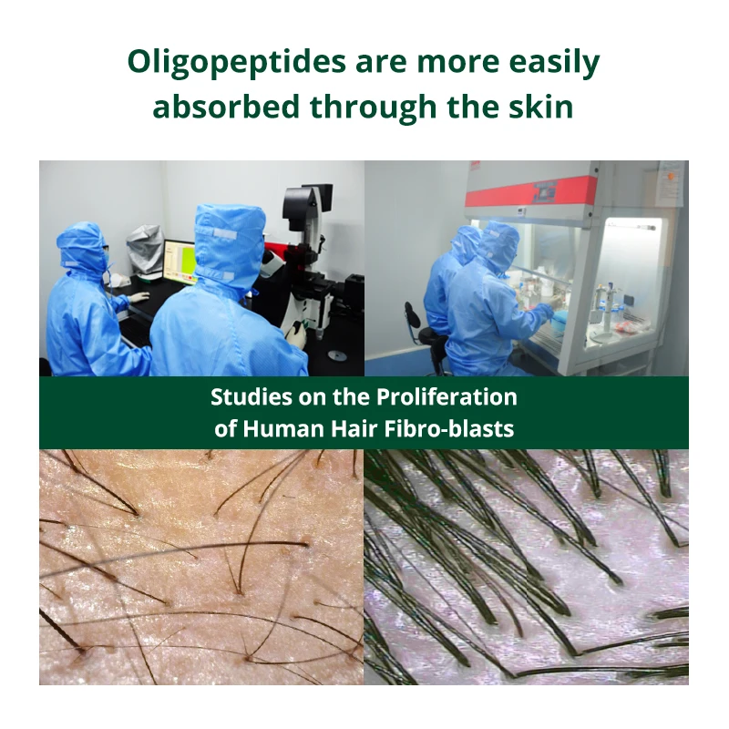 Custom Logo Best Quality Natural Fast Hair Growth Oil for Businessman