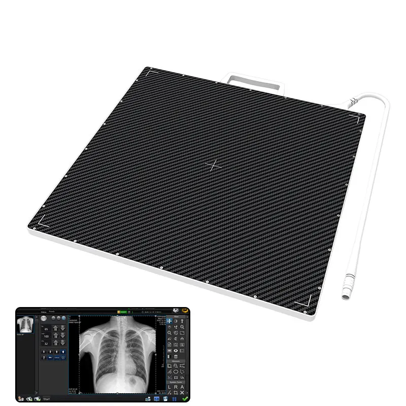 Digital X-ray GOS/CSI Wired 17x17 DR X Ray Flat Panel Detector for Human and Vet Use