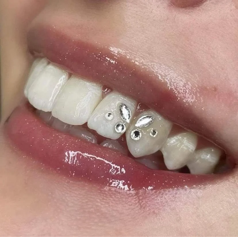 Beauty Diamond Butterfly Dental Crystal Tooth Jewelry Ornaments Crystals Stone Tooth Gem Gorgeous Smile