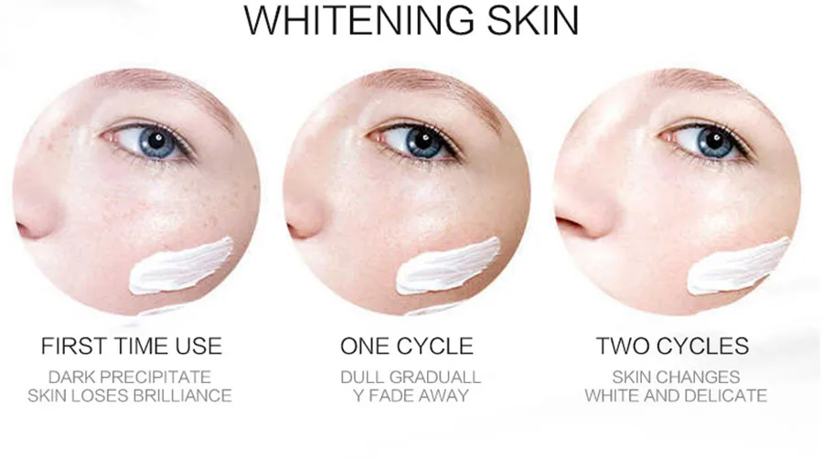 Effective Whitening Freckle Cream Remove Melasma Acne Spot Pigment Melanin Dark Spots Pigmentation Moisturizing Whitening Cream