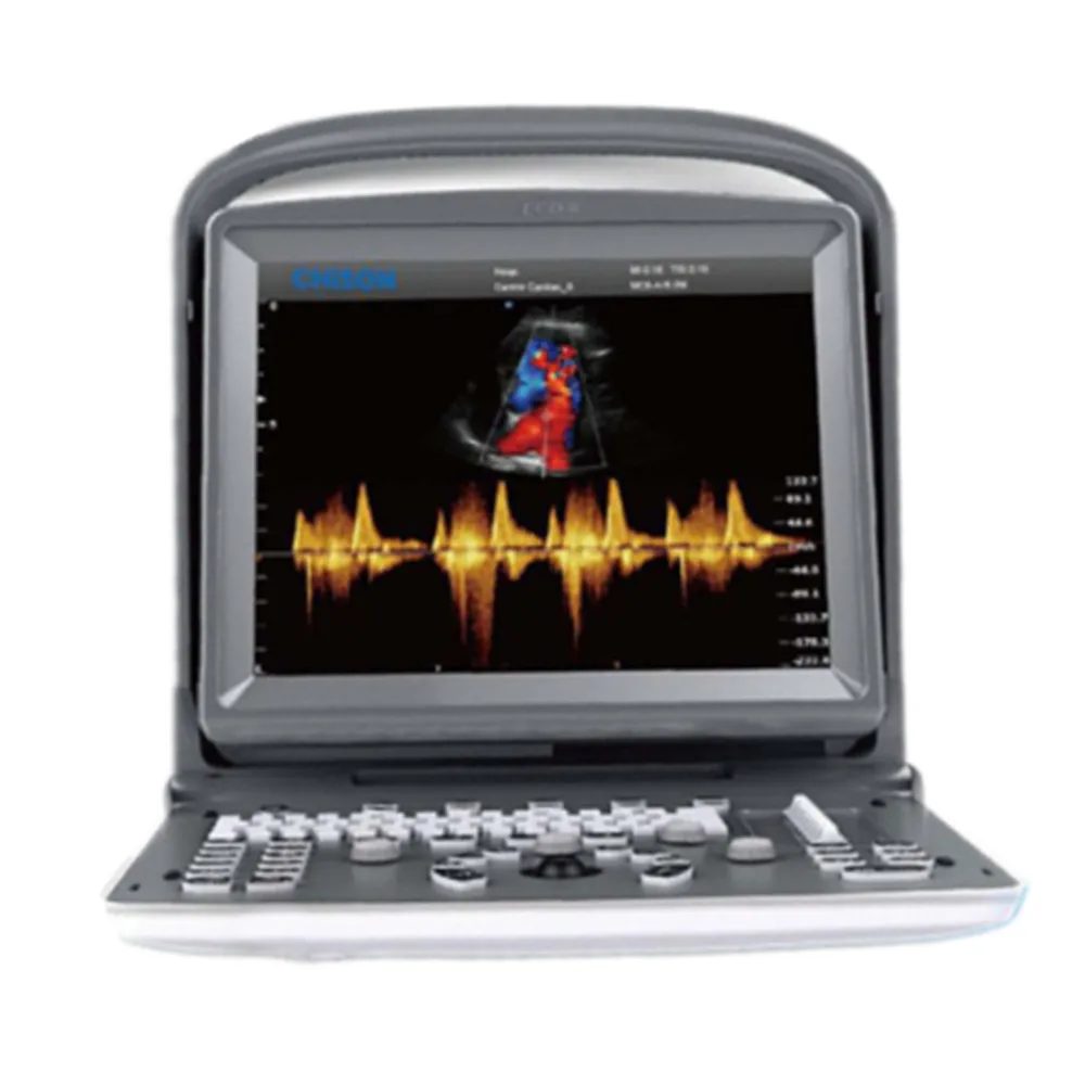 Factory Price Color Doppler Ultrasound Scanner 3D/4D Portable Scanner Chison ECO5 Ultrasound Machine